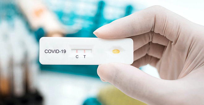 Cambios en el protocolo Covid