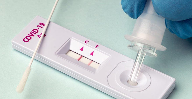 Las farmacias notificarán desde hoy a Sanidad los test positivos, y gratis